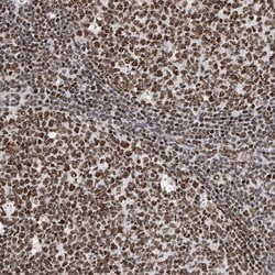 Invitrogen SRSF6 Polyclonal Antibody 100 &mu;L; Unconjugated:Antibodies,