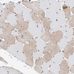 Invitrogen SRSF6 Polyclonal Antibody 100 &mu;L; Unconjugated:Antibodies,
