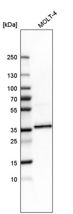 Invitrogen SRSF6 Polyclonal Antibody 100 &mu;L; Unconjugated:Antibodies,