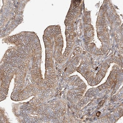 Invitrogen CSMD3 Polyclonal Antibody 100 &mu;L; Unconjugated:Antibodies,