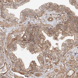 Invitrogen CSMD3 Polyclonal Antibody 100 &mu;L; Unconjugated:Antibodies,