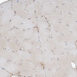 Invitrogen CSMD3 Polyclonal Antibody 100 &mu;L; Unconjugated:Antibodies,