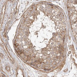 Invitrogen CSMD3 Polyclonal Antibody 100 &mu;L; Unconjugated:Antibodies,