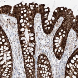 Invitrogen ETHE1 Polyclonal Antibody 100 &mu;L; Unconjugated:Antibodies,