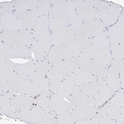 Invitrogen ETHE1 Polyclonal Antibody 100 &mu;L; Unconjugated:Antibodies,