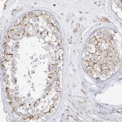 Invitrogen ETHE1 Polyclonal Antibody 100 &mu;L; Unconjugated:Antibodies,