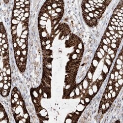 Invitrogen ETHE1 Polyclonal Antibody 100 &mu;L; Unconjugated:Antibodies,