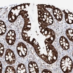 Invitrogen ETHE1 Polyclonal Antibody 100 &mu;L; Unconjugated:Antibodies,