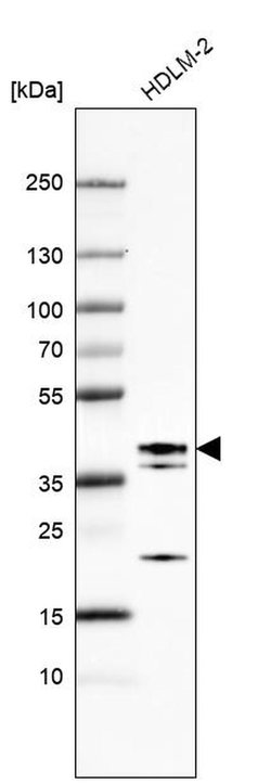 Invitrogen ETV7 Polyclonal Antibody 100 &mu;L; Unconjugated:Antibodies,