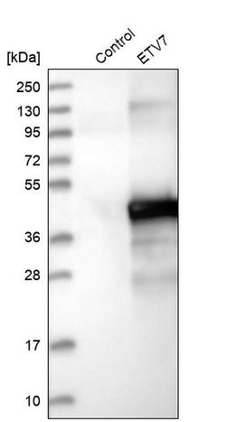 Invitrogen ETV7 Polyclonal Antibody 100 &mu;L; Unconjugated:Antibodies,