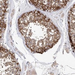 Invitrogen LRRC16A Polyclonal Antibody 100 &mu;L; Unconjugated:Antibodies,