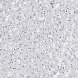 Invitrogen LRRC16A Polyclonal Antibody 100 &mu;L; Unconjugated:Antibodies,