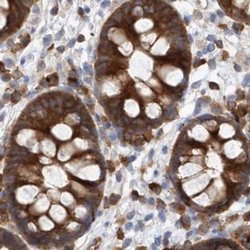 Invitrogen LRRC16A Polyclonal Antibody 100 &mu;L; Unconjugated:Antibodies,