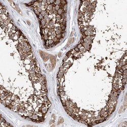 Invitrogen LRRC16A Polyclonal Antibody 100 &mu;L; Unconjugated:Antibodies,