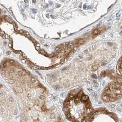 LRRC16A Polyclonal Antibody, Invitrogen 100 &mu;L; Unconjugated:Antibodies,