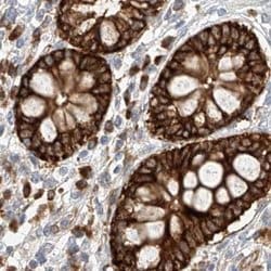 LRRC16A Polyclonal Antibody, Invitrogen 100 &mu;L; Unconjugated:Antibodies,