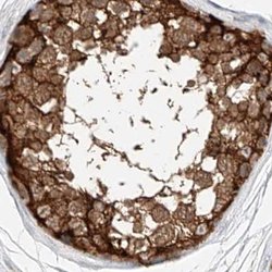 LRRC16A Polyclonal Antibody, Invitrogen 100 &mu;L; Unconjugated:Antibodies,