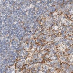 LRRC16A Polyclonal Antibody, Invitrogen 100 &mu;L; Unconjugated:Antibodies,