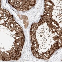 LRRC16A Polyclonal Antibody, Invitrogen 100 &mu;L; Unconjugated:Antibodies,