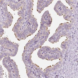 Invitrogen LCA5 Polyclonal Antibody 100 &mu;L; Unconjugated:Antibodies,