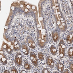 Invitrogen TIMM17B Polyclonal Antibody 100 &mu;L; Unconjugated:Antibodies,