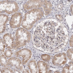 Invitrogen TIMM17B Polyclonal Antibody 100 &mu;L; Unconjugated:Antibodies,