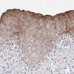 Invitrogen TIMM17B Polyclonal Antibody 100 &mu;L; Unconjugated:Antibodies,