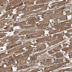 Invitrogen Kir2.1 (KCNJ2) Polyclonal Antibody 100 &mu;L; Unconjugated:Antibodies,