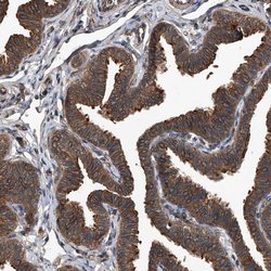 Invitrogen Kir2.1 (KCNJ2) Polyclonal Antibody 100 &mu;L; Unconjugated:Antibodies,