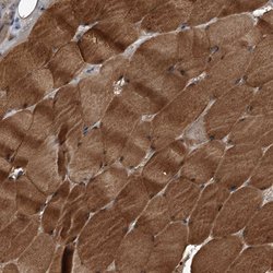 Invitrogen Kir2.1 (KCNJ2) Polyclonal Antibody 100 &mu;L; Unconjugated:Antibodies,