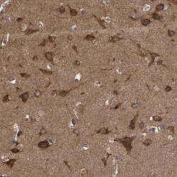 Invitrogen Kir2.1 (KCNJ2) Polyclonal Antibody 100 &mu;L; Unconjugated:Antibodies,