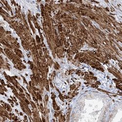 Invitrogen C1orf85 Polyclonal Antibody 100 &mu;L; Unconjugated:Antibodies,