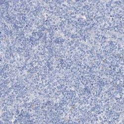 Invitrogen C1orf85 Polyclonal Antibody 100 &mu;L; Unconjugated:Antibodies,