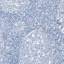 Invitrogen HSD17B13 Polyclonal Antibody 100 &mu;L; Unconjugated:Antibodies,
