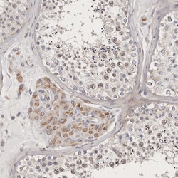 Invitrogen MRPS10 Polyclonal Antibody 100 &mu;L; Unconjugated:Antibodies,