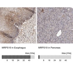 Invitrogen MRPS10 Polyclonal Antibody 100 &mu;L; Unconjugated:Antibodies,