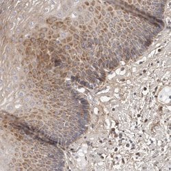 Invitrogen MRPS10 Polyclonal Antibody 100 &mu;L; Unconjugated:Antibodies,