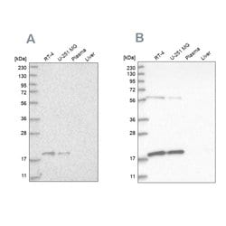 Invitrogen MRPS10 Polyclonal Antibody 100 &mu;L; Unconjugated:Antibodies,