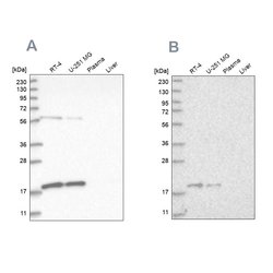Invitrogen MRPS10 Polyclonal Antibody 100 μL; Unconjugated:Antibodies,