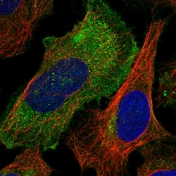 Invitrogen RAB23 Polyclonal Antibody 100 μL; Unconjugated:Antibodies,
