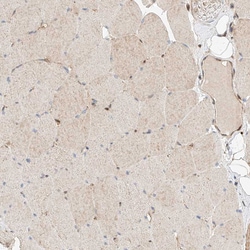 Invitrogen RAB23 Polyclonal Antibody 100 μL; Unconjugated:Antibodies,
