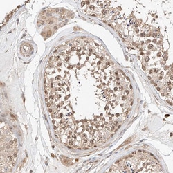 Invitrogen RAB23 Polyclonal Antibody 100 μL; Unconjugated:Antibodies,