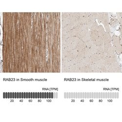 Invitrogen RAB23 Polyclonal Antibody 100 μL; Unconjugated:Antibodies,