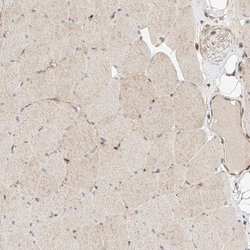 Invitrogen RAB23 Polyclonal Antibody 100 μL; Unconjugated:Antibodies,