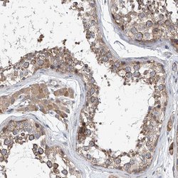 Invitrogen CEP85L Polyclonal Antibody 100 &mu;L; Unconjugated:Antibodies,