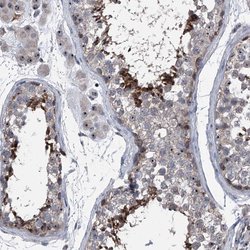 Invitrogen CEP85L Polyclonal Antibody 100 &mu;L; Unconjugated:Antibodies,