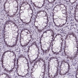 Invitrogen NOL7 Polyclonal Antibody 100 &mu;L; Unconjugated:Antibodies,