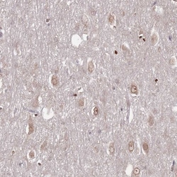 Invitrogen TBC1D25 Polyclonal Antibody 100 &mu;L | Buy Online | Invitrogen&trade; | Fisher Scientific