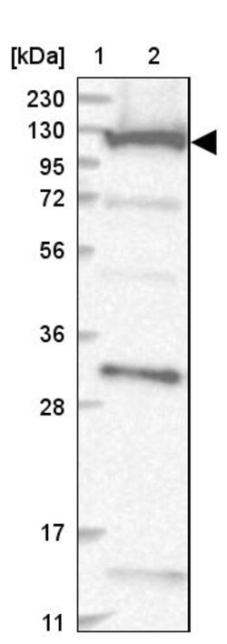 Invitrogen COG1 Polyclonal Antibody 100 &mu;L; Unconjugated:Antibodies,