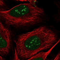 Invitrogen TSEN15 Polyclonal Antibody 100 &mu;L; Unconjugated:Antibodies,